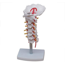 Cervical model with carotid artery, posterior occipital bone, intervertebral disc and nerve